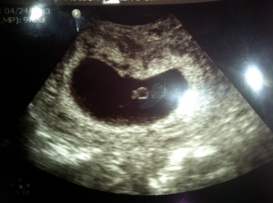 Baby Moser 2013